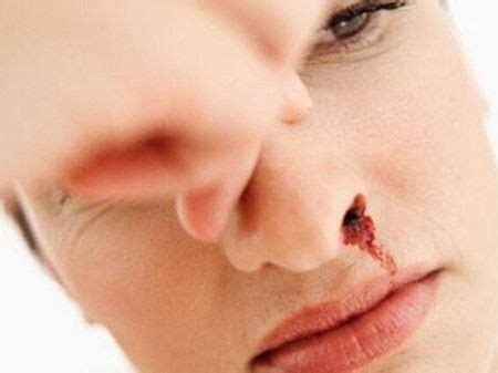 女人梦见自己流鼻血是什么预兆解梦（不同的人解释也不同）