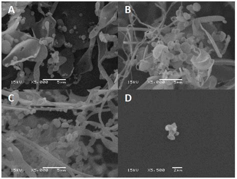 Development of a Lyophilization Process for Campylobacter Bacteriophage ...