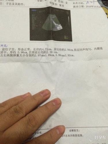 今日孕23周胎儿股骨径标准（孕23周胎儿股骨长标准）_华夏文化传播网