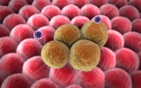 Image result for Lymphocytes Cancer