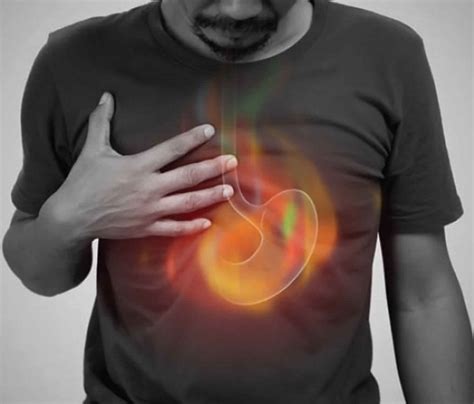 Heartburn, causes, symptoms, complications, diagnosis & treatment