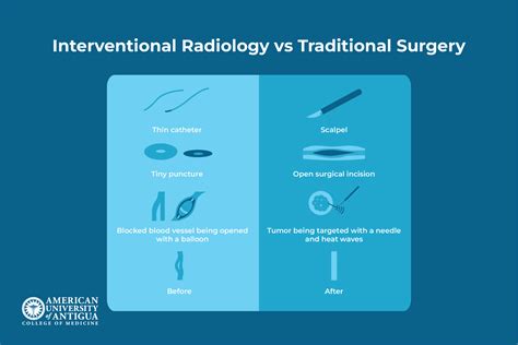 What Is Interventional Radiology? Procedures and Treatments