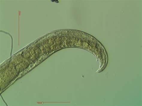 Anyone has an idea what is the species/genus name of this nematode? | ResearchGate