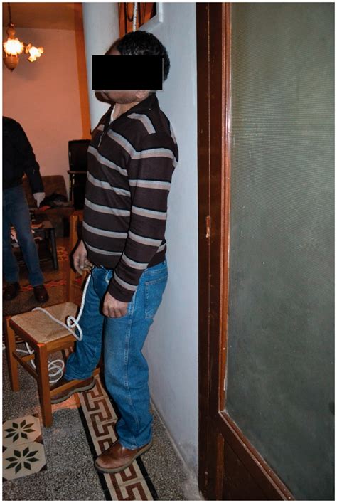 When a suicide becomes a forensic enigma: The role of hanging marks and ...