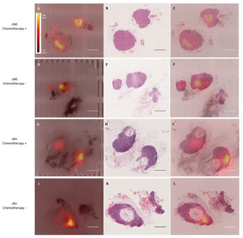 Cancers | Special Issue : Biophotonics and Imaging for Cancer Screening ...