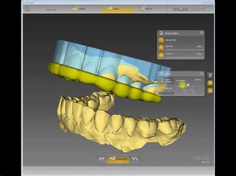 Image result for Inlab Splint Design