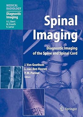 Buy Spinal Imaging: Diagnostic Imaging of the Spine and Spinal Cord ...