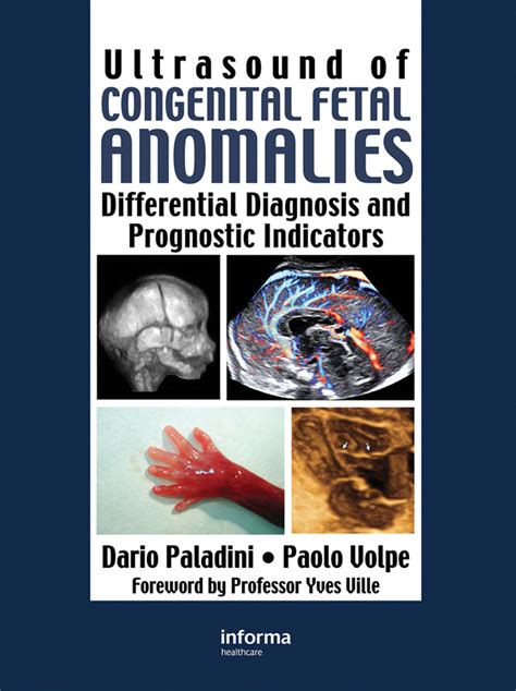 Ultrasound Of Congenital Fetal Anomalies Differential Diagnosis And ...