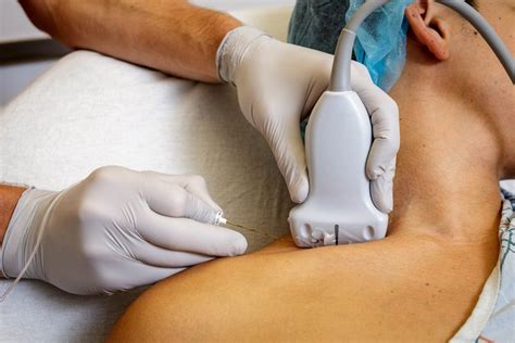 Injection Therapy 的图像结果