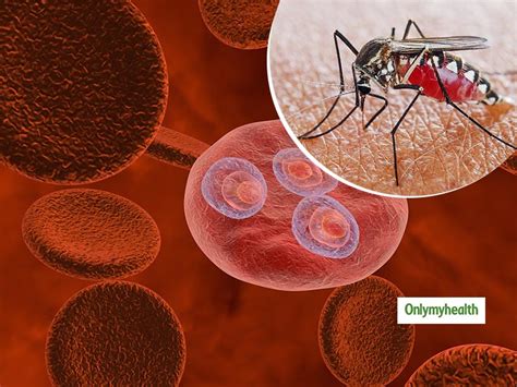 Possible To Eradicate Malaria From India: Says UK Medical Journal ...