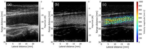 Sensors | Special Issue : Ultrasound/Photoacoustic Sensing and Imaging ...