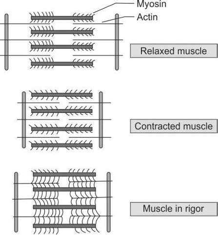 The Last Reflex – What Cadaveric Spasm Reveals About Death?