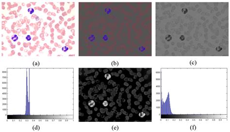 Segmentation of White Blood Cells through Nucleus Mark Watershed ...