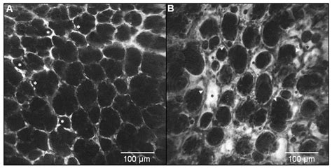 In Vivo Endomicroscopy of Lung Injury and Repair in ARDS: Potential ...