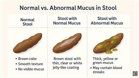 Mucus in Stool: What It Means, Causes, and When to Act