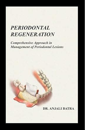 Buy PERIODONTAL REGENERATION Comprehensive Approach in Management of ...