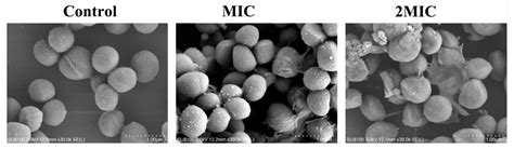 Control of Foodborne Staphylococcus aureus by Shikonin, a Natural Extract