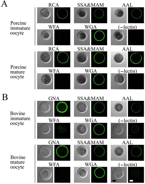 Binding of Sperm to the Zona Pellucida Mediated by Sperm Carbohydrate ...