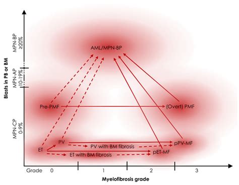 Progression of Myeloproliferative Neoplasms (MPN): Diagnostic and ...