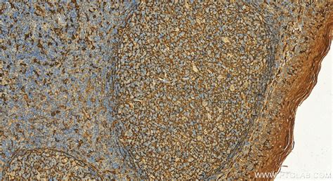 CD14 antibody (30796-1-AP) | Proteintech