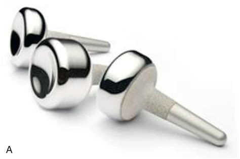 Prosthetic Radial Head 的图像结果