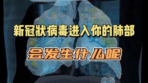 新冠病毒有多顽强？零下20度可存活20年，零下80度仍不会被冻死！多国肉类加工厂现集体感染，如何吃肉才安全？_凤凰网