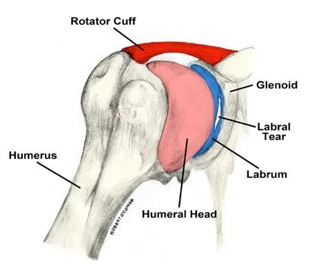 Labral Tear- Shoulder — Tulane Orthopaedics