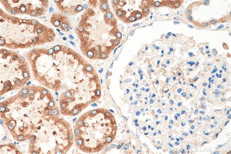 FATP2 antibody (14048-1-AP) | Proteintech