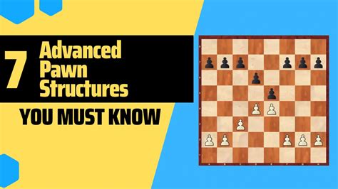 Image result for Chess Structures