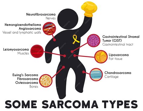Premium Vector | Infographic showing some sarcoma types and principal ...