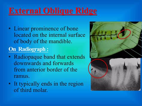 mandibular landmarks of radiograph | PPTX