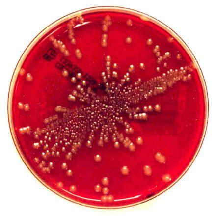 What Does It Mean When A Urine Culture Showed Mixed Flora