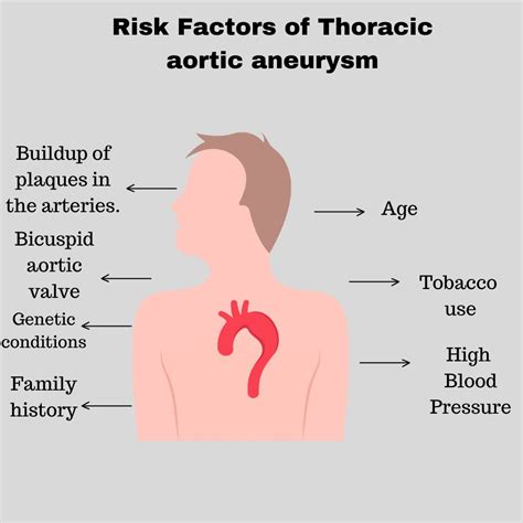 Thoracic aortic aneurysm: Causes, Risk Factors, Symptoms, Treatment