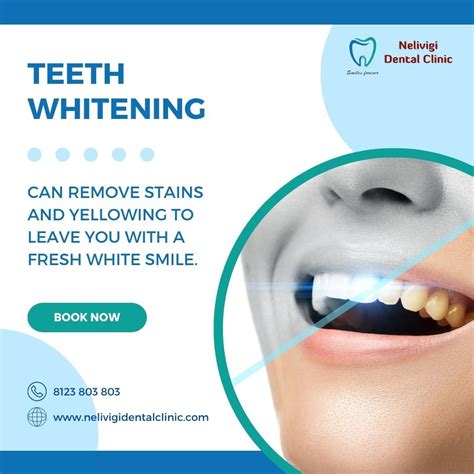 Get rid of Stains and Yellow teeth | Best Dental Clinic in Bellandur | Nelivigi Dental Clinic ...