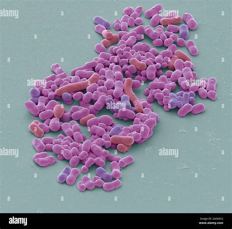 Neisseria gonorrhoeae bacteria, coloured scanning electron micrograph ...