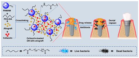 Antibiotic-Loaded Dendrimer Hydrogels in Periodontal Bone Regeneration ...