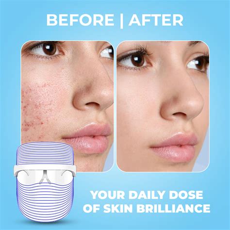 3 in 1 LED Face Mask for Anti Aging & Anti Acne - Winston – Winston ...