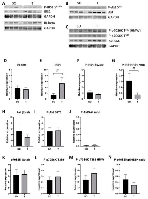 Increased Skeletal Muscle Fiber Cross-Sectional Area, Muscle Phenotype ...