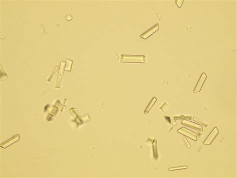 Triple Phosphate Crystals Dog Urine at Ava Ewers blog