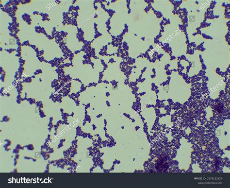 Staphylococcus Aureus Under Microscope 的图像结果