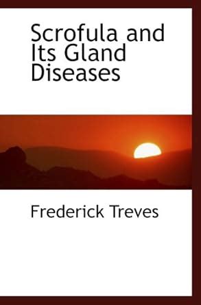 Scrofula and Its Gland Diseases : Amazon.in: Books