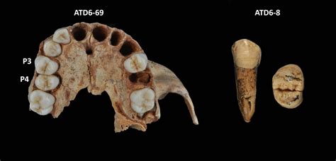 Neanderthals are not the only species whose dentition is characterized by the possession of thin ...