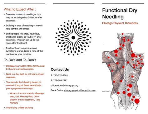 Dry Needling — Chicago Physical Therapists