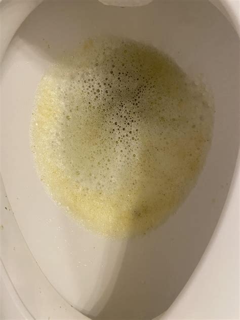 Need help. Foamy diarrhea. : r/poop