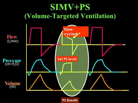 Image result for APRV Mode Explained