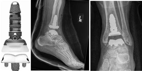 Hardware Monitor Driver 的图像结果