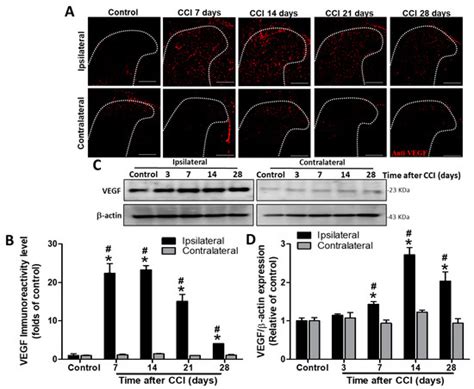 Biomedicines | Special Issue : Neuropathic Pain: Therapy and Mechanisms
