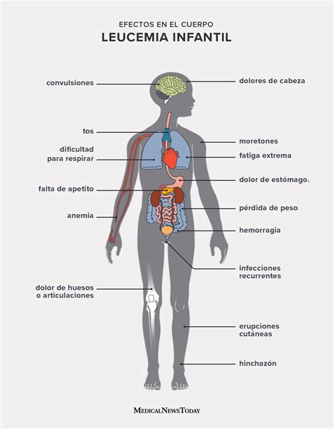 11 síntomas de leucemia en niños
