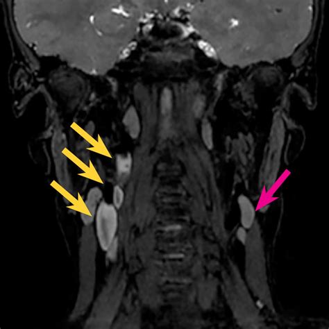 ISMRM 2025 abstracts