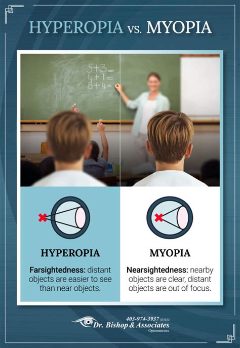 Image result for Myopia Hyperopia